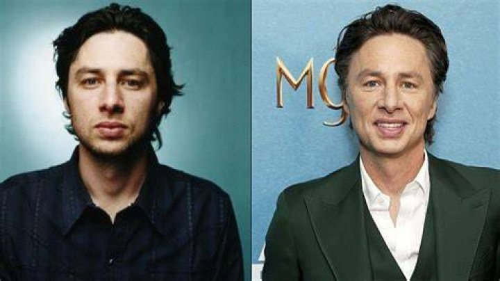Zach Braff Plastic Surgery 2024 Before And After Photos